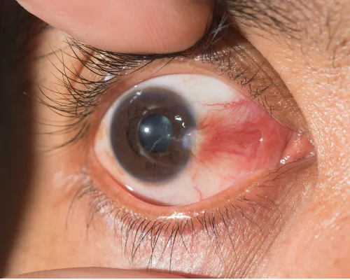 Leading eye treatment hospital in Colombo