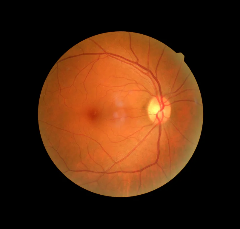 best eye care hospital in colombo