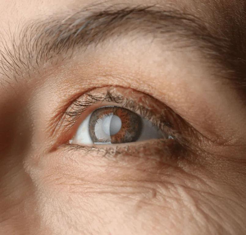 Eye Care Hospital in Colombo
