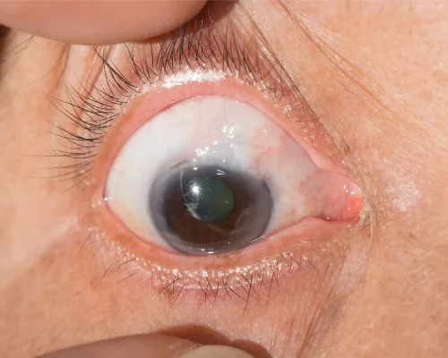 Best eye checking hospital in Sri Lanka