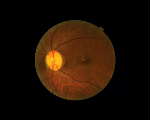Most trusted eye hospital in Colombo