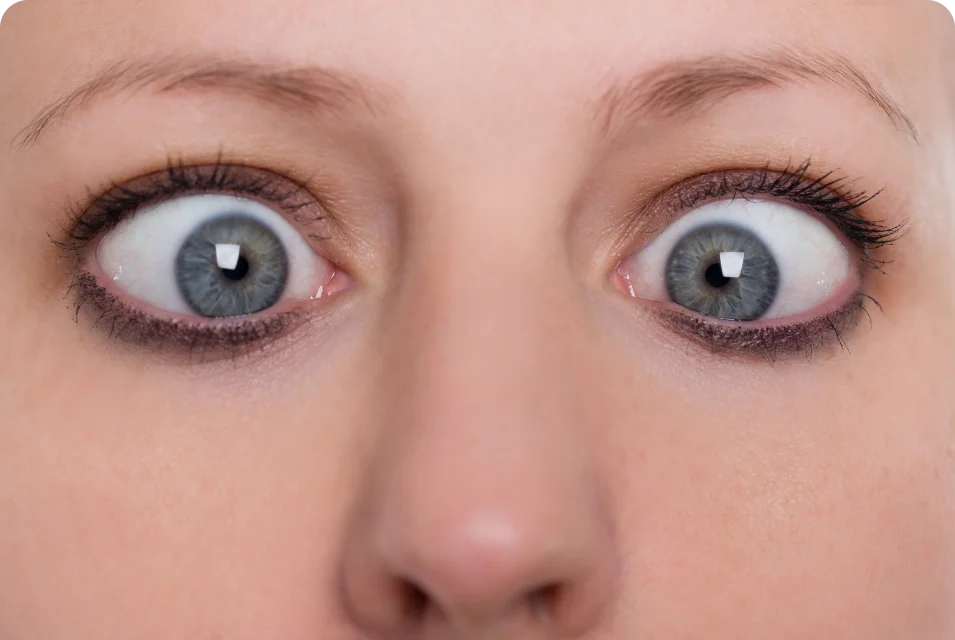 ocular plasty