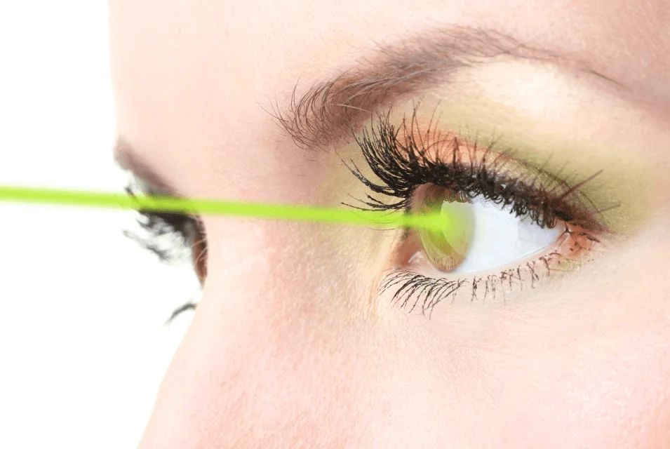 refractive surgery