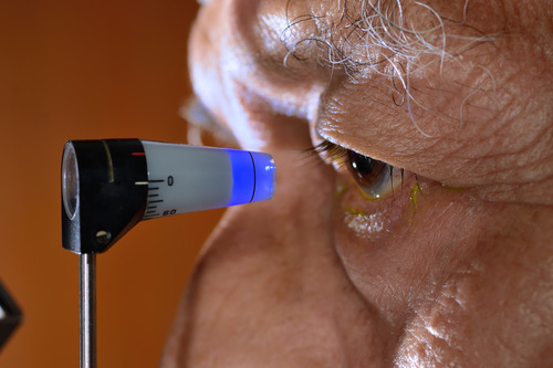 Vasan Eye Care Hospital - cataract surgery cost in sri lanka