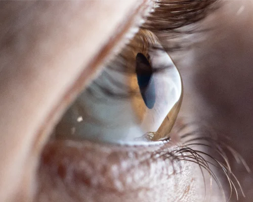 Best eye checking hospital in Sri Lanka
