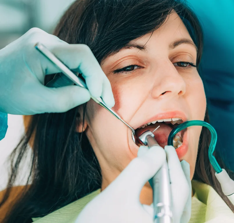 Safe tooth removal at Vasan Healthcare Hospital