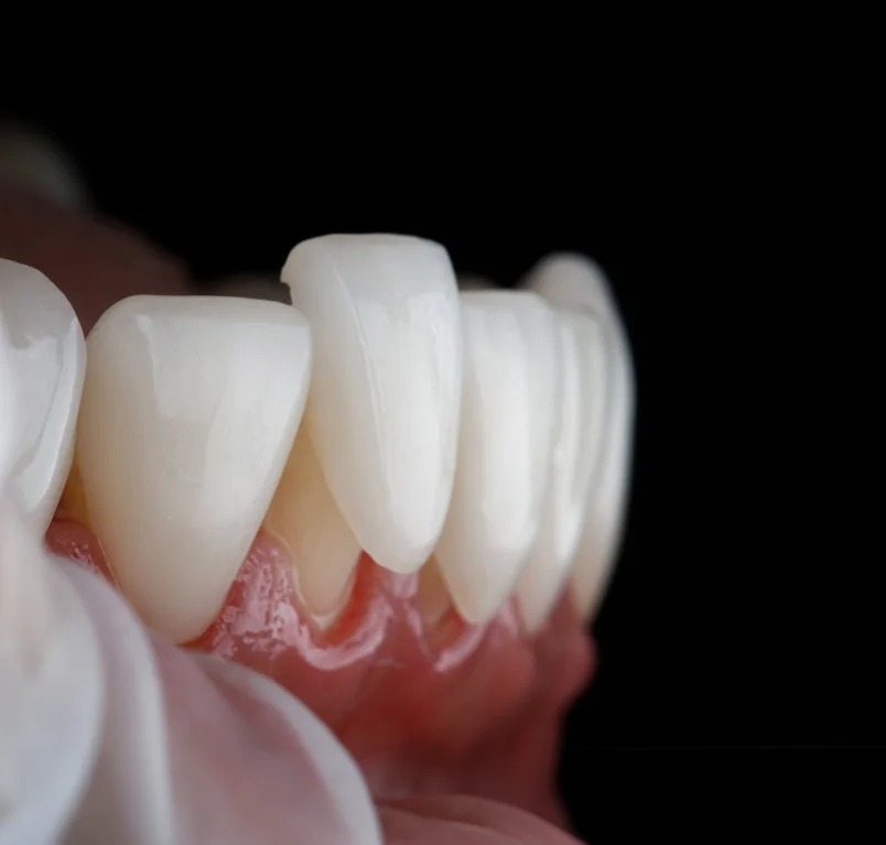 Dental solutions at Vasan Healthcare Hospital
