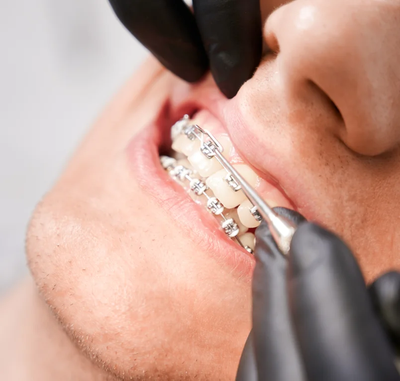 Dental treatments at Vasan Healthcare Hospital