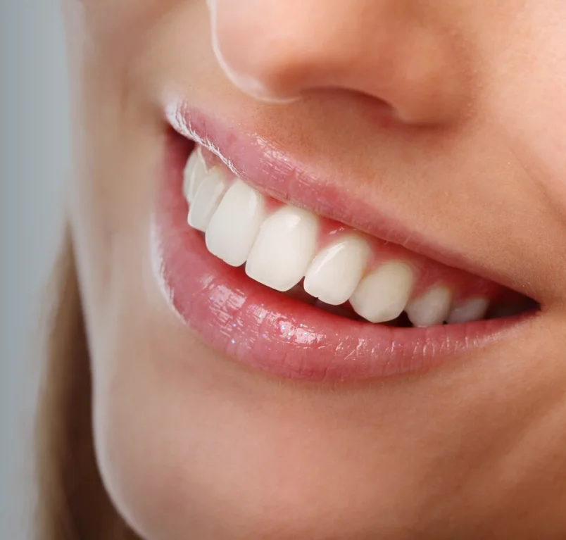 Personalized smile enhancement services